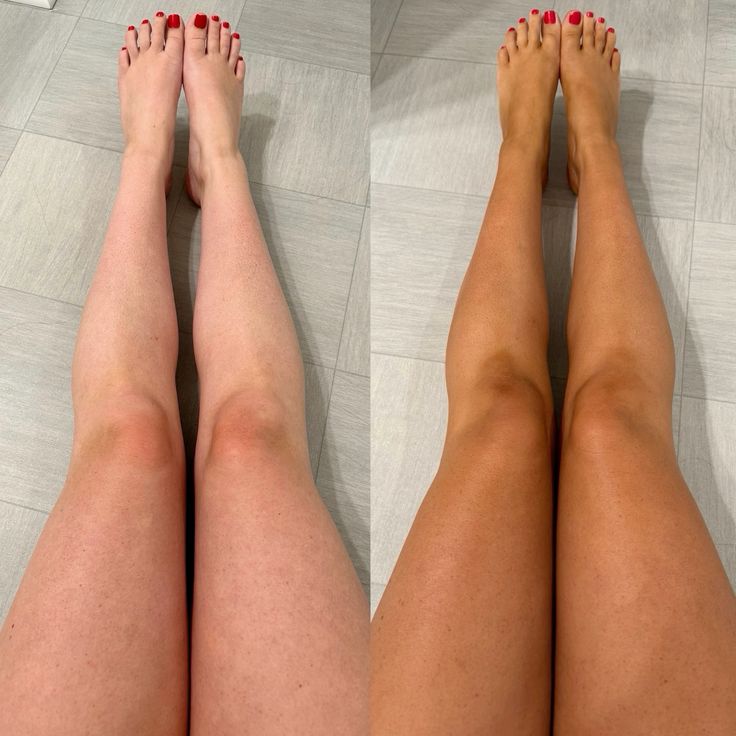 Suntini™ drinkable tanning drops